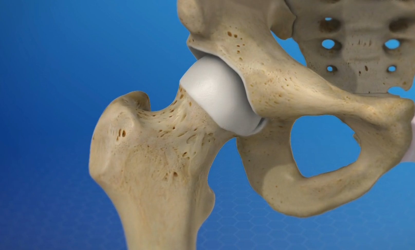 Anatomy of the Hip