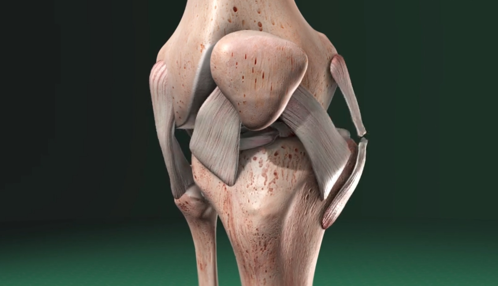 Understanding The Medial Ulnar Collateral Ligament Of The